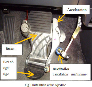 Fig.1 Installation of the Npedal