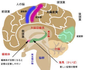 brain1