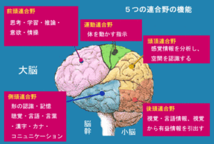 brain3